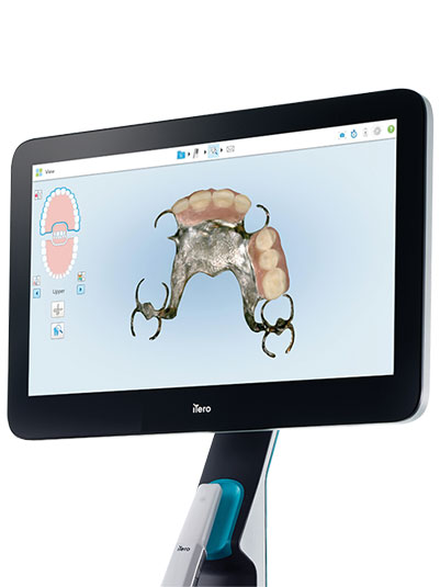 itero lumina intraoral scanner